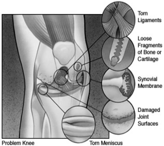 knee